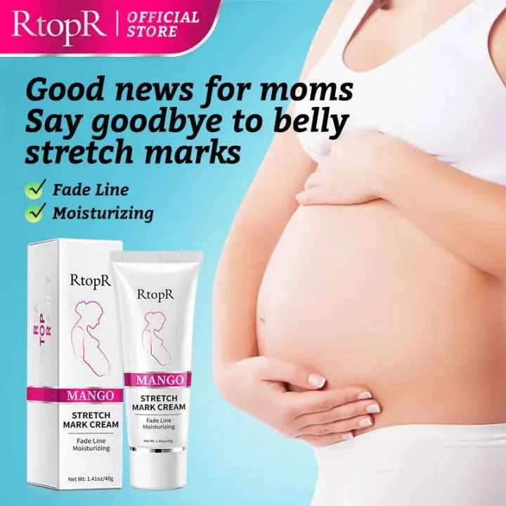 RtopR Mango Anti-Stretch Mark Cream: Natural Prenatal & Postnatal Skin Smoothing Lotion for Moms