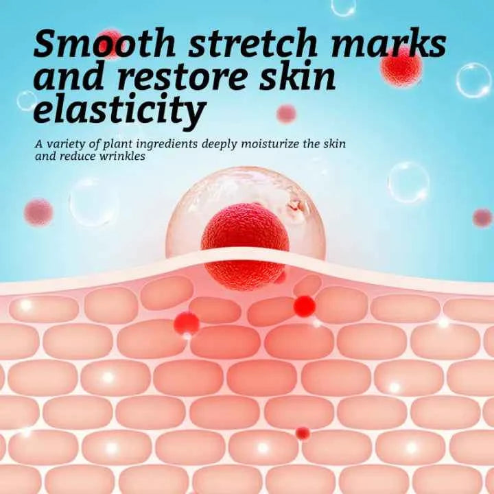 RtopR Mango Anti-Stretch Mark Cream: Natural Prenatal & Postnatal Skin Smoothing Lotion for Moms