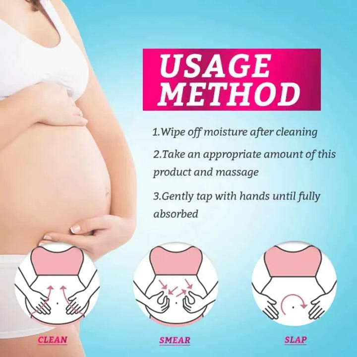 RtopR Mango Anti-Stretch Mark Cream: Natural Prenatal & Postnatal Skin Smoothing Lotion for Moms
